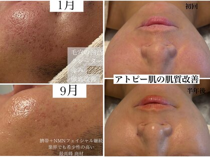 サロン ド エメ(salon de aimer)の写真