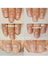 ニコプラス(NICO+)/自爪育成パラジェルクリア補強