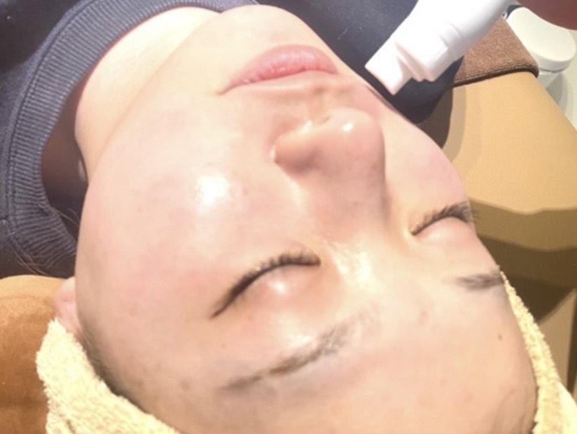 拡大鏡エステ　アイサロン　毛穴サロン　廃盤品 拡大鏡エステ アイサロン 毛穴サロン 廃盤品