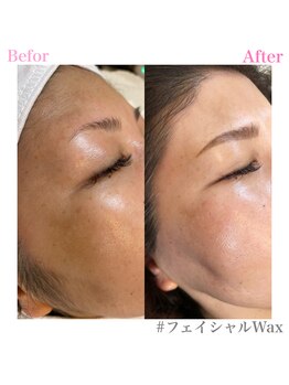 プリュスマイル(+Smile.)/フェイシャルワックス