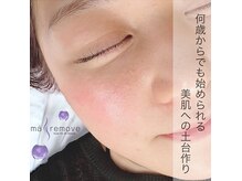 アロマスイーツ(AromaSweets)/マリムーブフェイシャルワックス