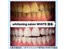 ホワイトニングサロン ホワイト(WHITE)/セルフホワイトニング/大阪/福島