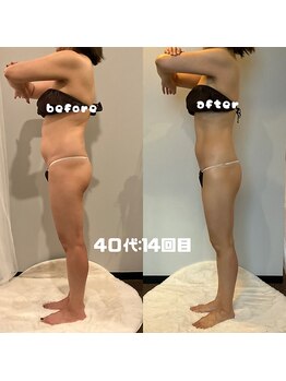 ソウソウビューティー 五反田(Shou Shou Beauty)/ビフォー★アフター14回目