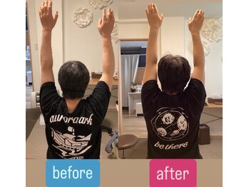 たすき鍼灸治療院/右肩の痛み