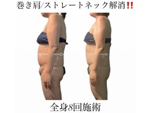痩身革命 大宮店/筋膜リリース/リンパ/ダイエット