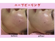 サロン ほほえむ(Fofo-m)/