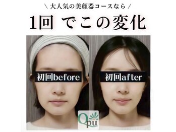 キュープ 高崎店(Qpu)の写真/【小顔頭蓋骨矯正+美肌美顔器コース￥11,000→￥9,900】美肌美顔器でお肌もツルツルに♪