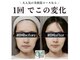 キュープ 高崎店(Qpu)の写真/【小顔頭蓋骨矯正+美肌美顔器コース￥11,000→￥9,900】美肌美顔器でお肌もツルツルに♪
