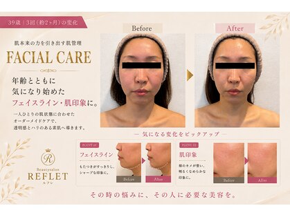 ルフレ(REFLET)の写真