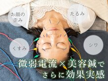 グリーンルーム鍼灸治療院