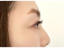 ラッシュガーデン(Lash Garden)/横から見たマツエク