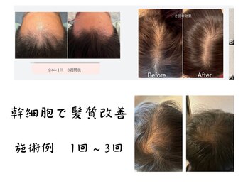 からだ庵 弘明寺本院/幹細胞上清液で抜け毛・細毛ケア