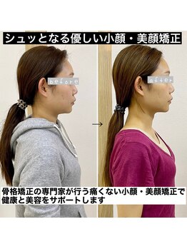 横浜DRT矯正院/気になるフェイスラインも改善☆
