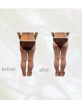 カリス(charis)/太もももスッキリ♪