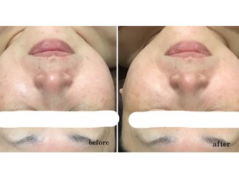 プリマプリート 各務原店/プラズマフォト