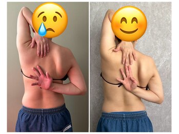 マイティー整骨院 ココア(CoCoa)/肩甲骨洗浄