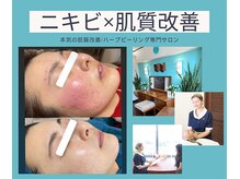 ノヴェイル 大濠店(NoVeil)