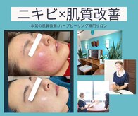 ノヴェイル 大濠店(NoVeil)