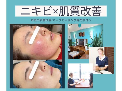 ノヴェイル 大濠店(NoVeil)の写真