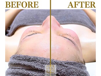 ヴェールブランシュ 町田(Vert Blanche)/#ブライダルエステ#フェイシャル