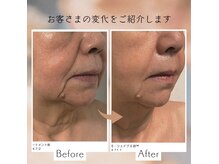 トータルスキンケア 美容ルーム(美容Room)の雰囲気（たるみ改善！その場で効果実感☆シワケア・たるみケア）