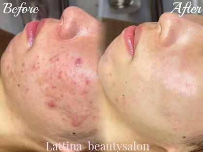 ラティーナ(Lattina)の写真