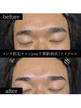 ユー 千葉駅前店(you)/ビフォ－アフター写真