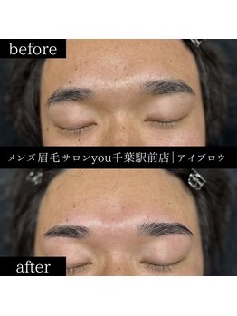 ユー 千葉駅前店(you)/ビフォ－アフター写真
