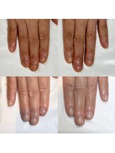 キュア(Cure.)/健康な美爪にする為の自爪育成
