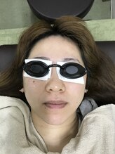 ナノハナ/鹿沼市の全身脱毛のナノハナ