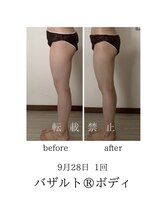 オン(On)/気になる下半身の施術写真