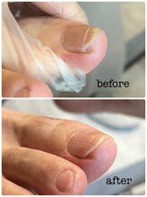 カラン(KARAN)/痛いやつ、、、