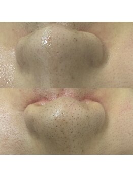 べべ アピタ福井大和田店(Be’be’)/お肌変化