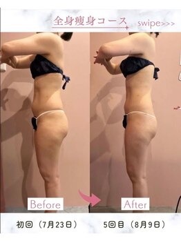 ビューティエン(beauty EN)/痩身ダイエットマッサージエステ