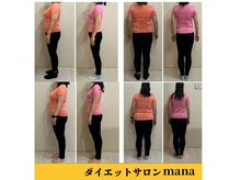 マナ(mana)の雰囲気（人気メニュー！夏までにスッキリボディーへ）