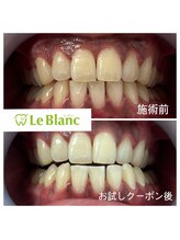 ルブラン 奈良店(Le Blanc)/お試しクーポンでもトーンアップ