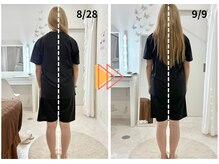 ラフィング(Laughing)/産後骨盤矯正