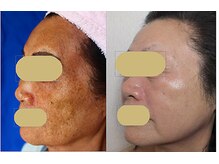 アイビューティーセンターの雰囲気（シミケアで美肌改善！自慢のお肌に変わります。）