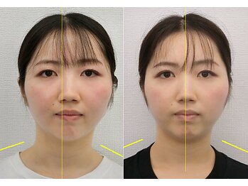 宮崎整体院/【美容整体】全身根本改善コース