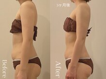 ユーフォリア グロウ(euphoria glow)/｛ ラフォス痩身120分 &nbsp;16回　｝