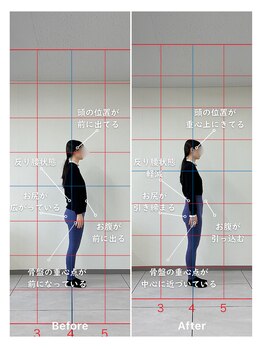 ハル 箕面(HALU)/初回体験before&after産後ケア