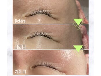 プラスベル(plus Belle)の写真/《再来率98%以上》毛穴シミシワほうれい線たるみなどに
日本初上陸の最先端韓国美容で徹底的にお悩み改善