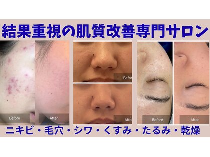 アネーロ 姫路店(ANHELO)の写真