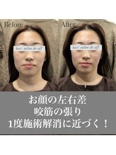 ハリサロンドオフ 心斎橋店(hari salon de off)/表情筋のコリ解消！
