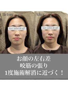 ハリサロンドオフ 心斎橋店(hari salon de off)/表情筋のコリ解消！