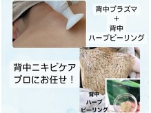 アールエム ボーテ(RM beaute')の雰囲気（【背中ニキビケア】プラズマ＋ハーブで長年の背中のお悩み解決！）