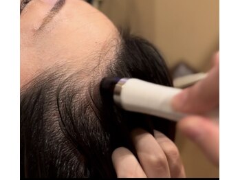 アキュレ(Acure)/頭皮洗浄