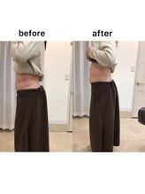 ジョワイユ(Joyeux)/腸の位置でお腹は変わる