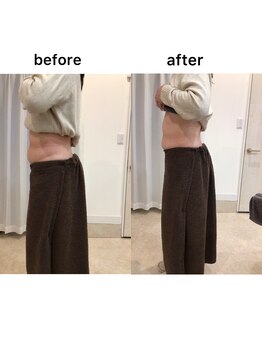 ジョワイユ(Joyeux)/腸の位置でお腹は変わる