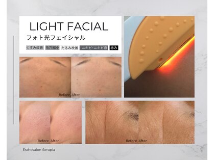 ゼクサースポーツスタジオ(ZEXER SPORTS STUDIO)の写真